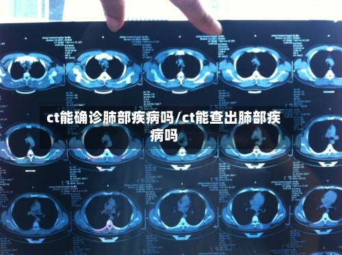 ct能确诊肺部疾病吗/ct能查出肺部疾病吗-第2张图片