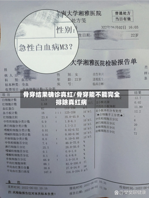 骨穿结果确诊真红/骨穿能不能完全排除真红病-第3张图片