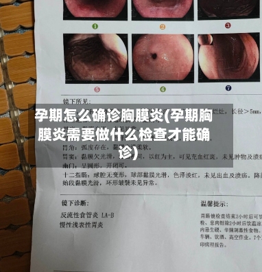 孕期怎么确诊胸膜炎(孕期胸膜炎需要做什么检查才能确诊)