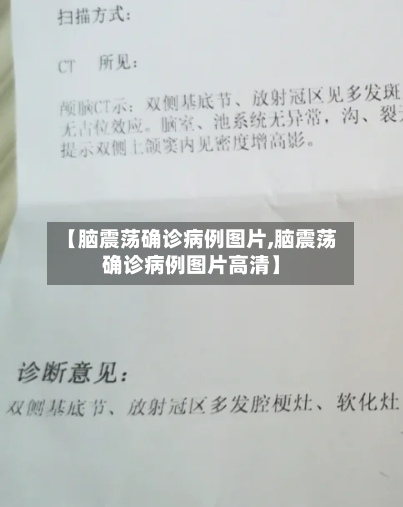 【脑震荡确诊病例图片,脑震荡确诊病例图片高清】
