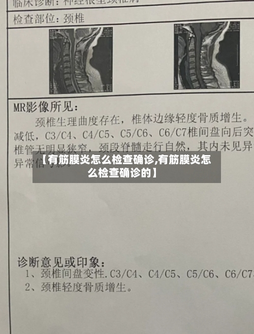【有筋膜炎怎么检查确诊,有筋膜炎怎么检查确诊的】