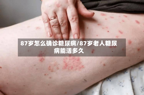 87岁怎么确诊糖尿病/87岁老人糖尿病能活多久