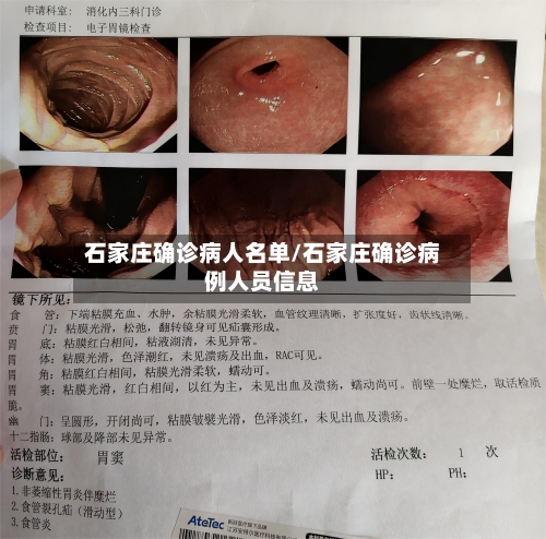 石家庄确诊病人名单/石家庄确诊病例人员信息-第2张图片