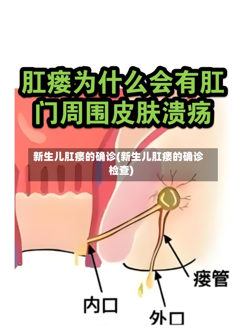 新生儿肛瘘的确诊(新生儿肛瘘的确诊检查)-第2张图片
