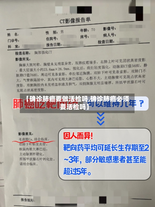 【确诊肺癌要做活检吗,确诊肺癌必须要活检吗】