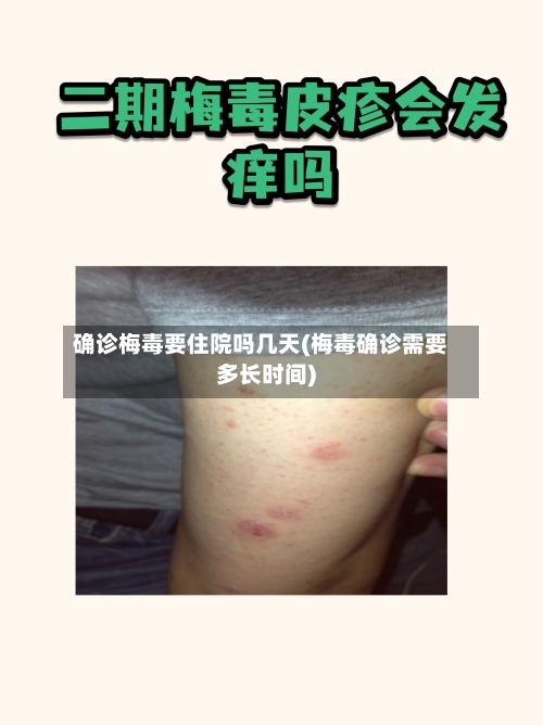 确诊梅毒要住院吗几天(梅毒确诊需要多长时间)