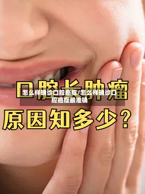 怎么样确诊口腔癌症/怎么样确诊口腔癌症最准确-第3张图片