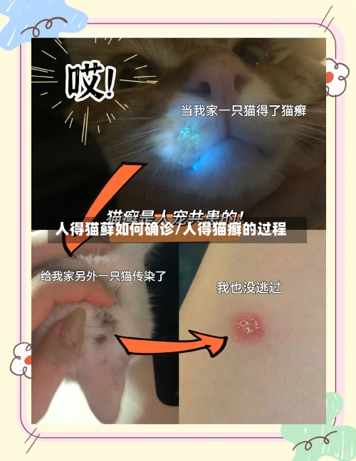人得猫藓如何确诊/人得猫癣的过程