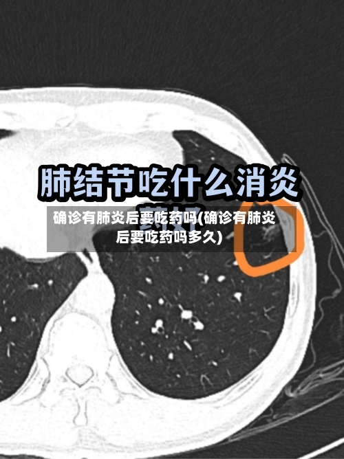 确诊有肺炎后要吃药吗(确诊有肺炎后要吃药吗多久)-第2张图片