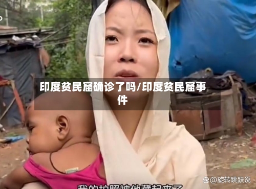 印度贫民窟确诊了吗/印度贫民窟事件-第2张图片