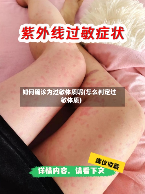 如何确诊为过敏体质呢(怎么判定过敏体质)