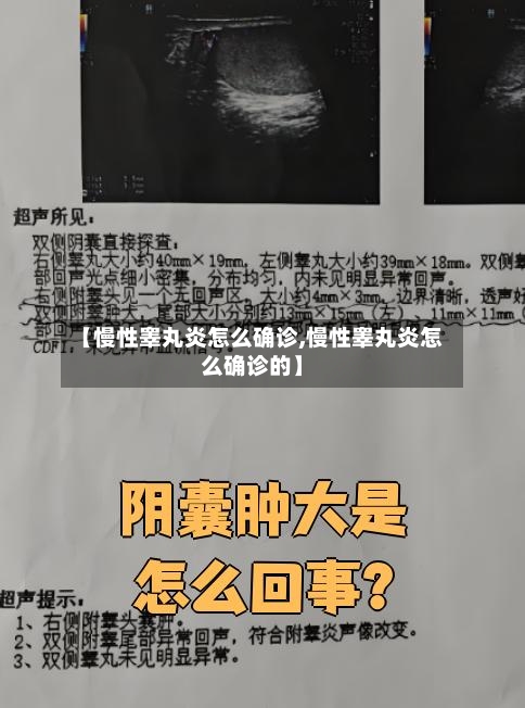 【慢性睾丸炎怎么确诊,慢性睾丸炎怎么确诊的】-第2张图片