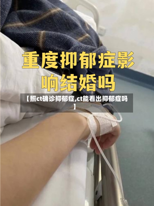 【照ct确诊抑郁症,ct能看出抑郁症吗】-第2张图片