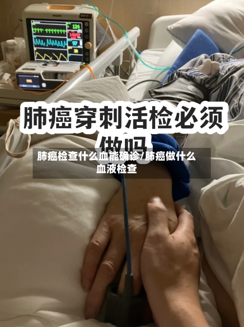肺癌检查什么血能确诊/肺癌做什么血液检查