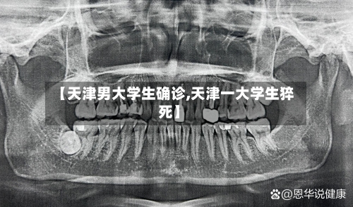 【天津男大学生确诊,天津一大学生猝死】-第2张图片