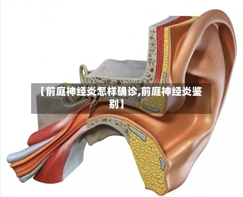 【前庭神经炎怎样确诊,前庭神经炎鉴别】