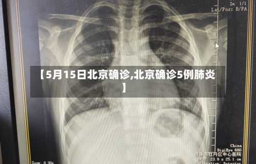 【5月15日北京确诊,北京确诊5例肺炎】