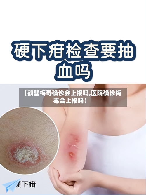 【鹤壁梅毒确诊会上报吗,医院确诊梅毒会上报吗】-第2张图片