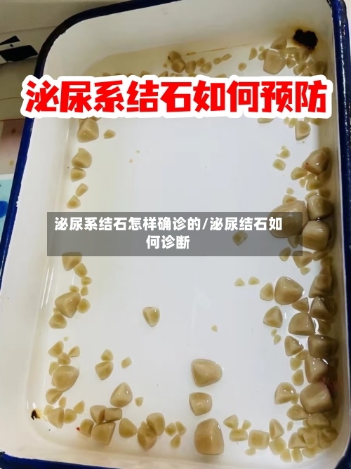 泌尿系结石怎样确诊的/泌尿结石如何诊断