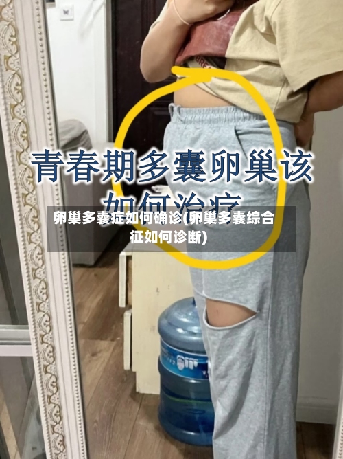 卵巢多囊症如何确诊(卵巢多囊综合征如何诊断)-第2张图片