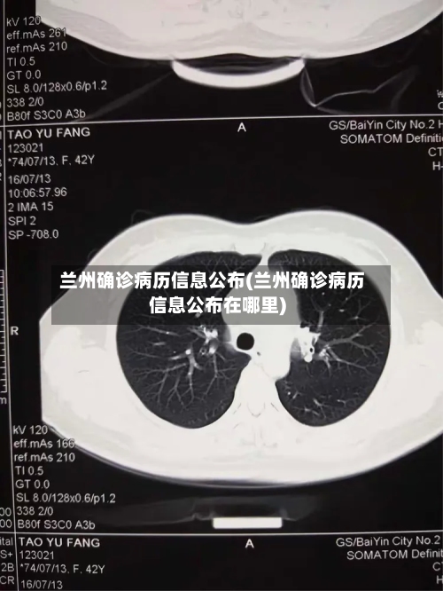 兰州确诊病历信息公布(兰州确诊病历信息公布在哪里)-第2张图片