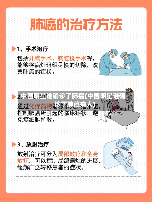 中国明星谁确诊了肺癌(中国明星谁确诊了肺癌病人)