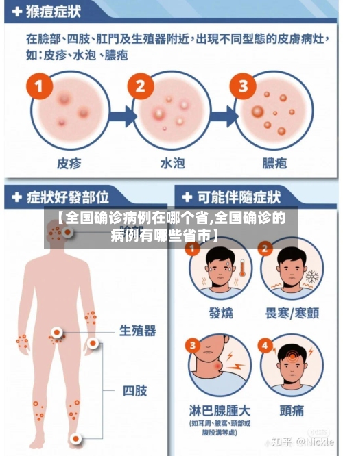【全国确诊病例在哪个省,全国确诊的病例有哪些省市】-第2张图片
