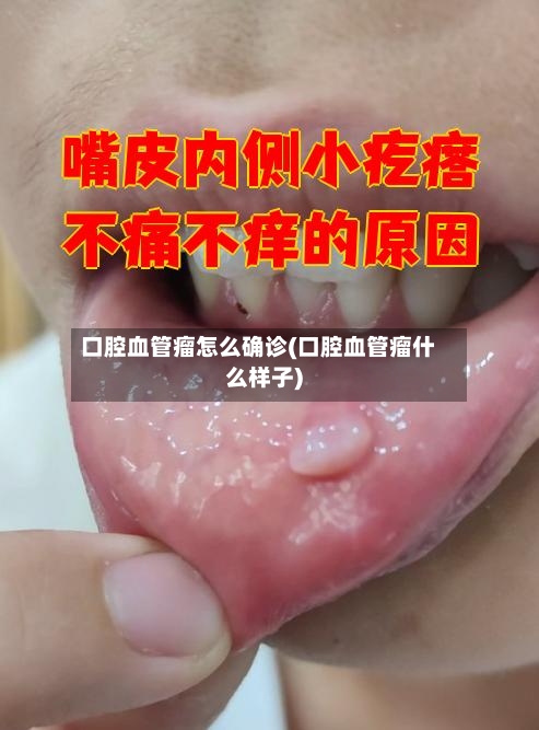 口腔血管瘤怎么确诊(口腔血管瘤什么样子)-第3张图片