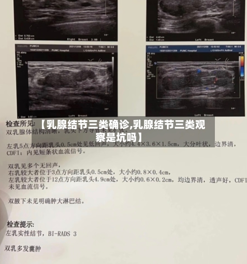 【乳腺结节三类确诊,乳腺结节三类观察是坑吗】