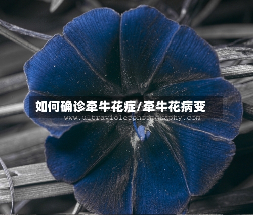 如何确诊牵牛花症/牵牛花病变-第2张图片