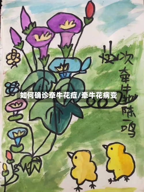 如何确诊牵牛花症/牵牛花病变-第3张图片