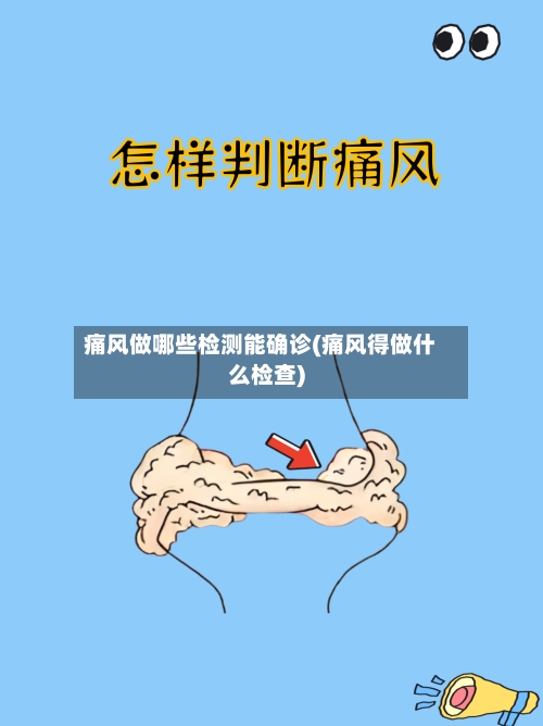 痛风做哪些检测能确诊(痛风得做什么检查)-第3张图片