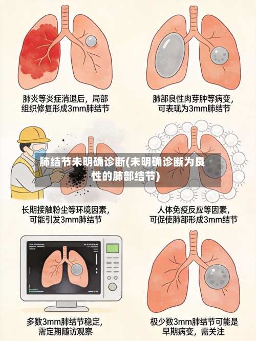 肺结节未明确诊断(未明确诊断为良性的肺部结节)-第3张图片