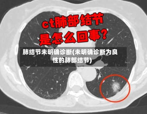 肺结节未明确诊断(未明确诊断为良性的肺部结节)