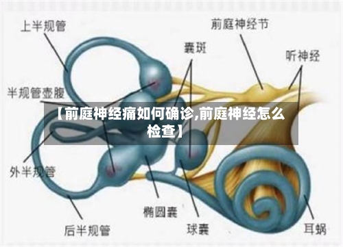 【前庭神经痛如何确诊,前庭神经怎么检查】