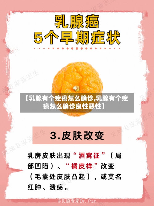 【乳腺有个疙瘩怎么确诊,乳腺有个疙瘩怎么确诊良性恶性】-第2张图片