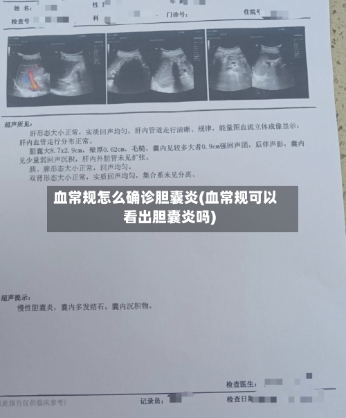 血常规怎么确诊胆囊炎(血常规可以看出胆囊炎吗)-第2张图片
