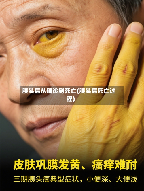 胰头癌从确诊到死亡(胰头癌死亡过程)-第2张图片