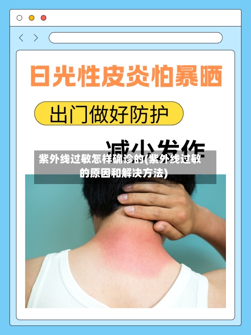 紫外线过敏怎样确诊的(紫外线过敏的原因和解决方法)-第2张图片