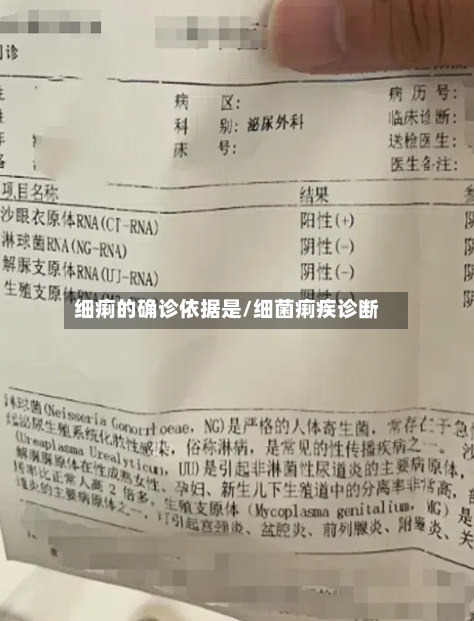 细痢的确诊依据是/细菌痢疾诊断-第2张图片