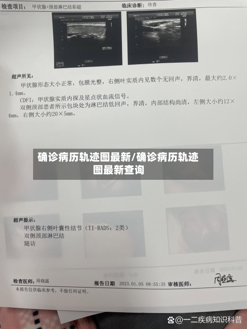 确诊病历轨迹图最新/确诊病历轨迹图最新查询-第2张图片