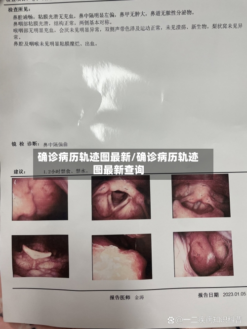 确诊病历轨迹图最新/确诊病历轨迹图最新查询