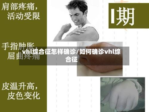 vhl综合征怎样确诊/如何确诊vhl综合征